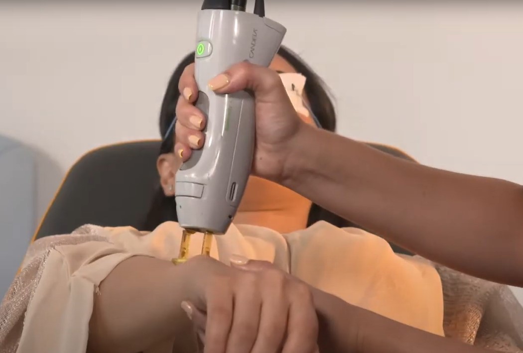 LASER TREATMENT LASER TREATMENT