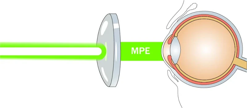 What Does Mpe Stand For In Laser Safety What Does Mpe Stand For In Laser Safety